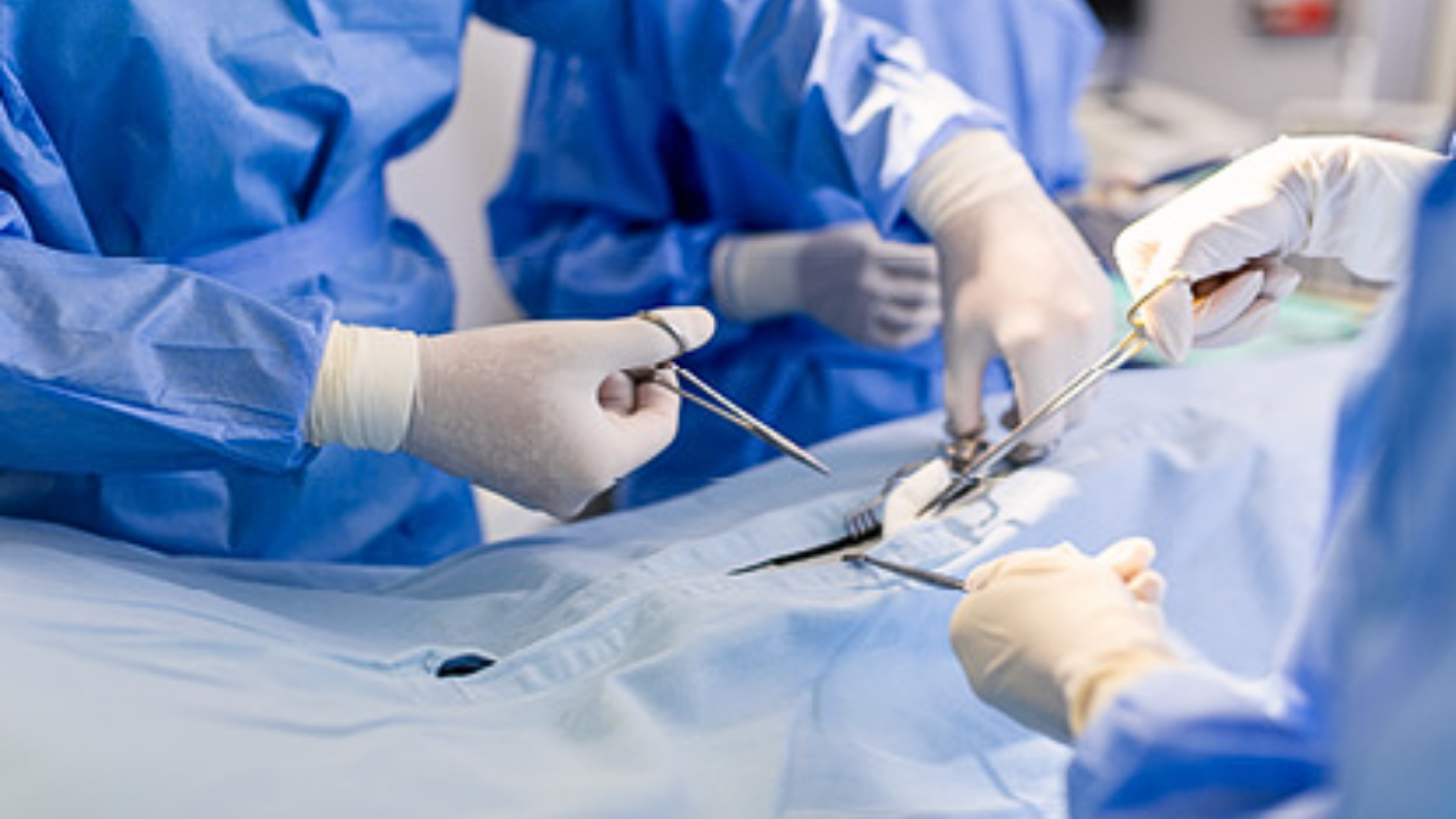 Vascular Anastomosis